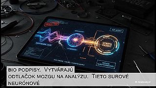 Ste neplatená pracovná sila - Ako váš mozog trénuje umelú inteligenciu...