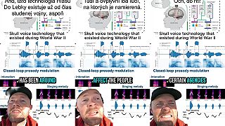 Vtipná definícia Hlasu Do Lebky