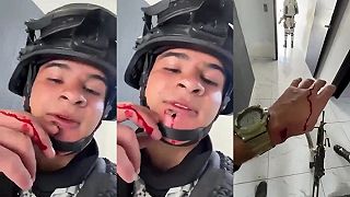 video Mexický vojak sa celý triasol, guľka od kartelu sa mu zavŕtala pod kožu na brade