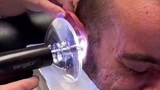 video A ako často si čistíte uši?