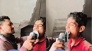 video Mohamed šiel k uznávanému zubárovi, ten mu zbrúsil zuby uhlovou brúskou