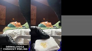 Derrmalogica chemický peeling, sezóna je na konci
