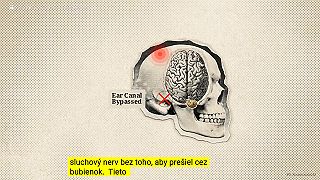 Nesmrtiaca medzera v zákone