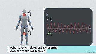 Zvrátenie Havanského syndrómu
