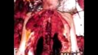 Disgorge - Rancid Bowel Sarcoma
