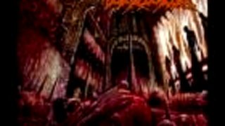 Vomepotro - Aborted Fetus