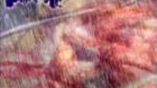 Lymphatic Secretion - Gorging on Festering Infectious Boils