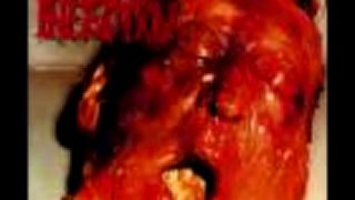 Dead Infection - Hospital