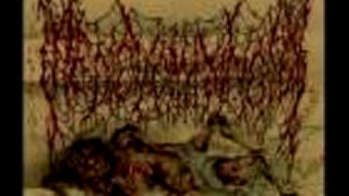 Medic Vomiting Pus - Sound of Complete Dislocation of cervial ve