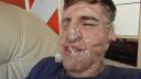 Jak dostat lepenku z obličeje [Vine]