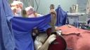 video Koncertoval, kým mu operovali hlavu (Brazília)