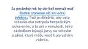 Zvazujete operaciu oka ?