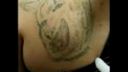 video Pokazené tetovania