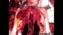 Disgorge - Rancid Bowel Sarcoma